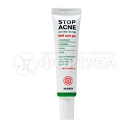 Гель для лица Hiskin Stop Acne 10 мл Точечный SOS Противовоспалительный AHA + BHA + TEA TREE